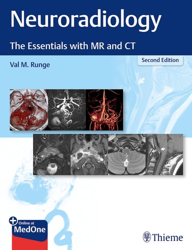 Neuroradiology The Essentials With Mr And Ct 2e Sep 14 20201684201535thiemepdf 2nd Edition Val M Runge