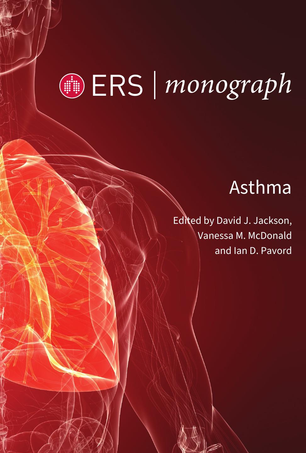 Asthma David J Jackson Vanessa M Mcdonald Ian D Pavord
