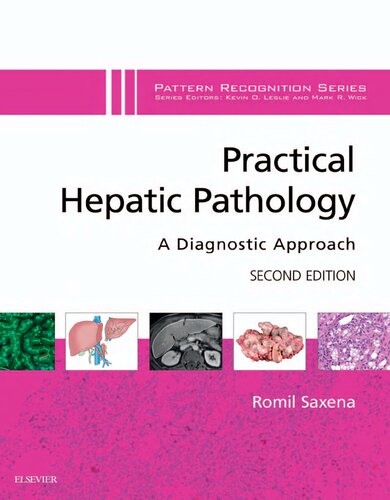 Practical Hepatic Pathology A Diagnostic Approach 2nd Edition Romil Saxena