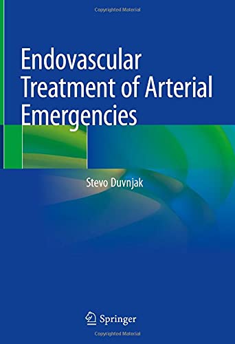 Endovascular Treatment Of Arterial Emergencies Stevo Duvnjak