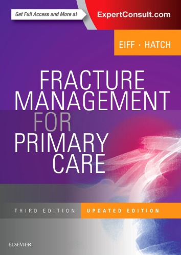 Fracture Management For Primary Care Updated Edition 3rd Edition M Patrice Eiff