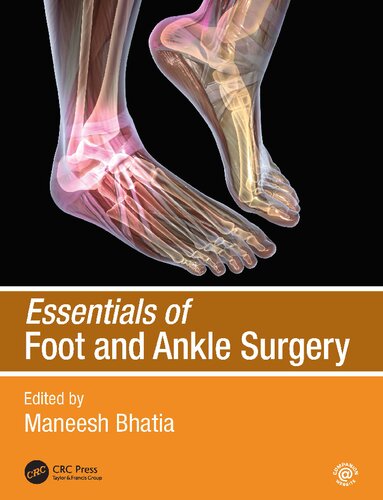 Essentials Of Foot And Ankle Surgery 1st Edition Maneesh Bhatia Editor