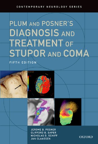 Plum And Posners Diagnosis And Treatment Of Stupor And Coma 5th Edition Nicholas D Schiff Jan Claassen Jerome B Posner Clifford B Saper