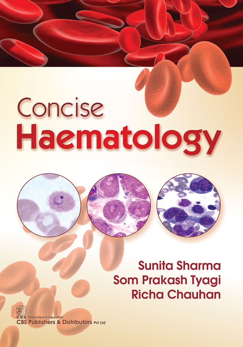 Concise Haematology First Edition Sunita Sharma