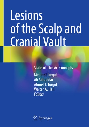 Lesions Of The Scalp And Cranial Vault Stateoftheart Concepts Mehmet Turgut