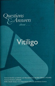 Questions Answers About Vitiligo National Institute Of Arthritis And Musculoskeletal And Skin Diseases