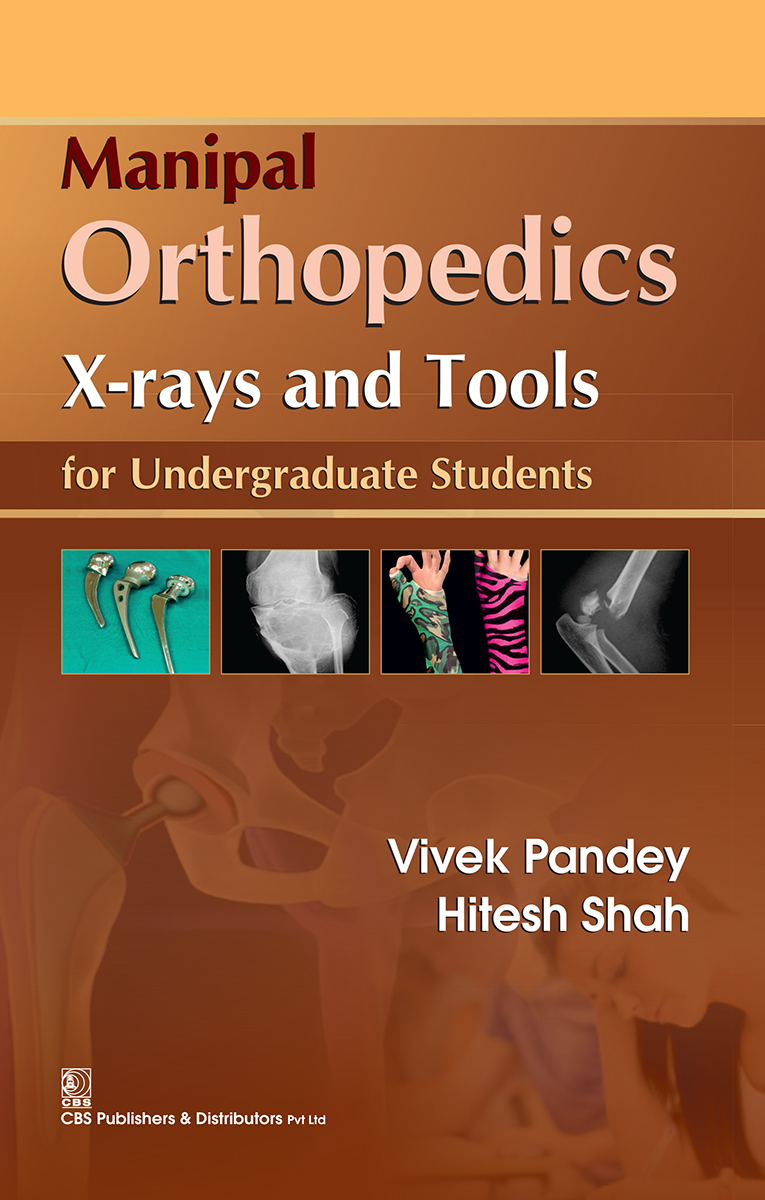 Manipal Orthopedics Xrays And Tools For Undergraduate Students First Edition Vivek Pandey Hitesh Shah