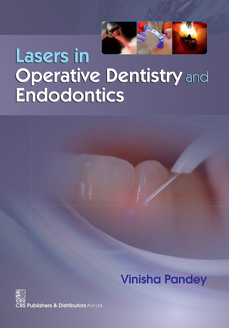 Laser In Operative Dentistry And Endodontics First Edition Vinisha Pandey