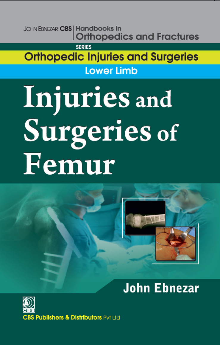 Injuries And Surgeries Of Femur First John Ebnezar