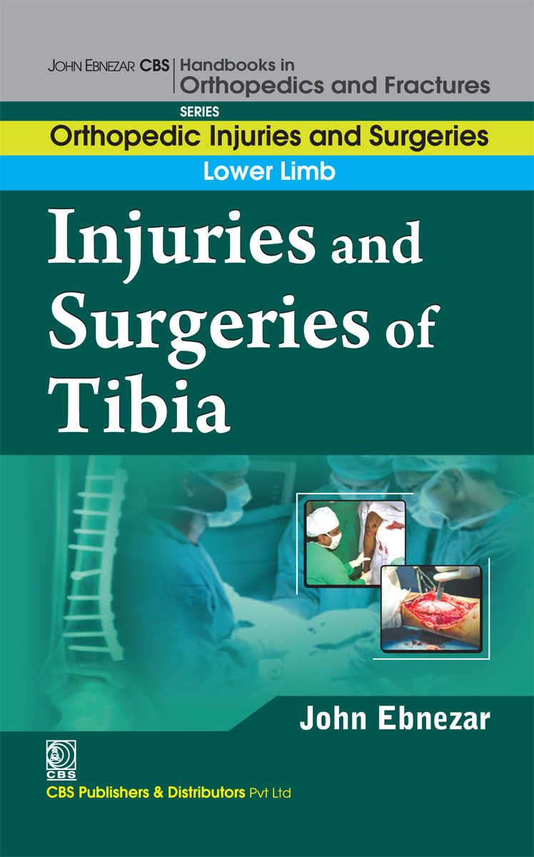 Injuries And Surgeries Of Tibia First Edition John Ebnezar