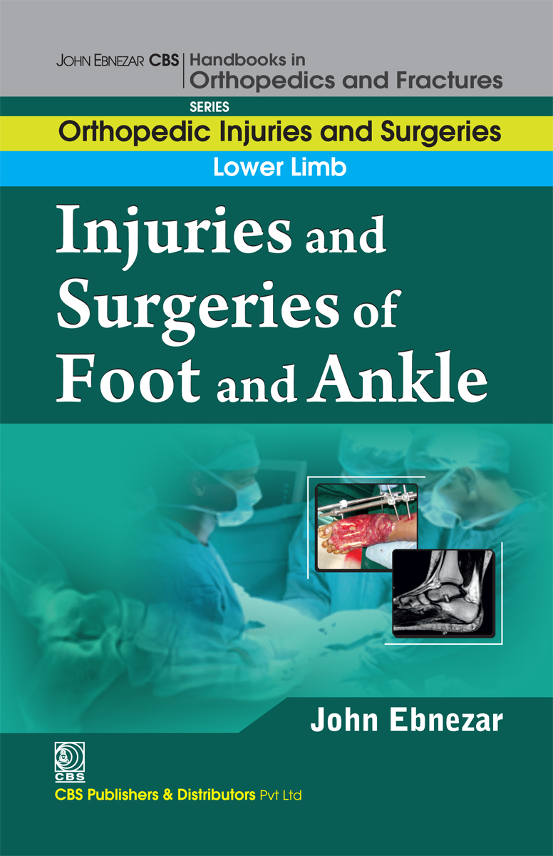 Injuries And Surgeries Of Foot And Ankle First Edition John Ebnezar