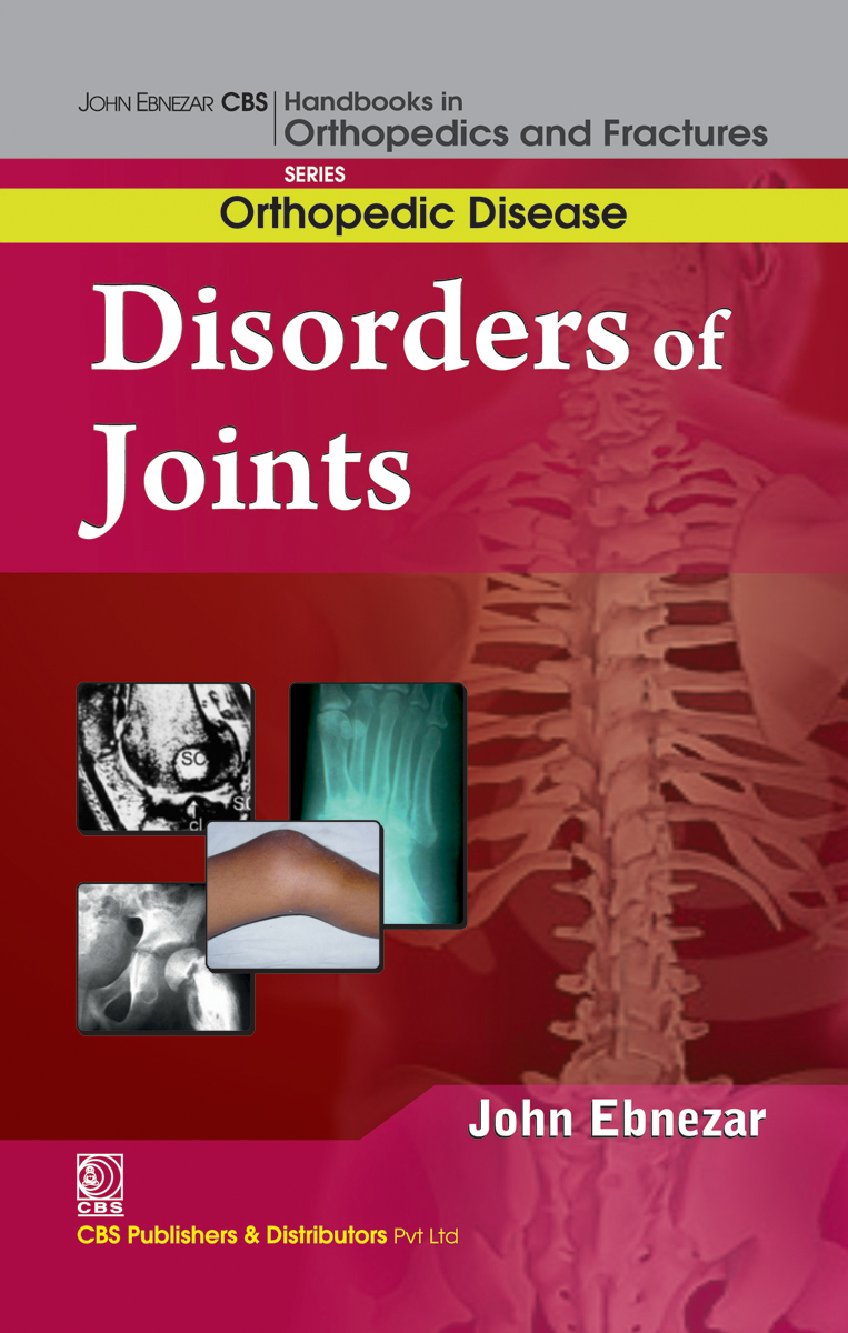 Disorder Of Joint First Edition John Ebnezar