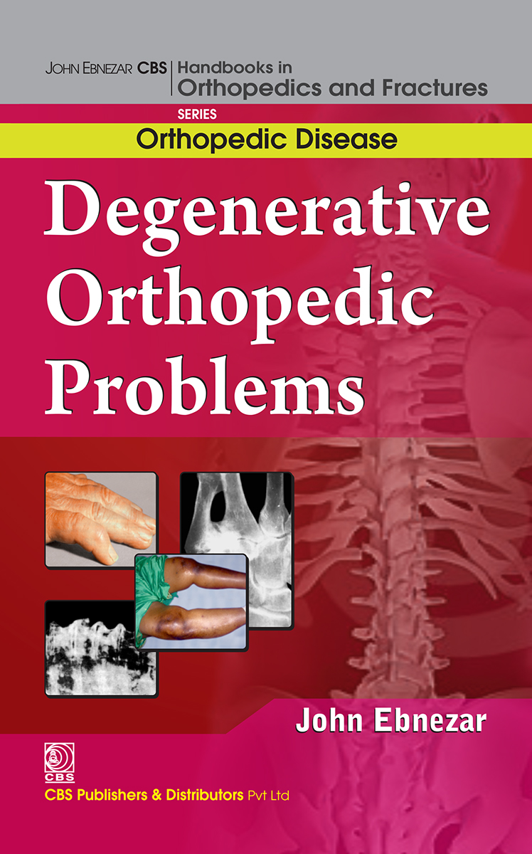 Degenerative Orthopedic Problems First Edition John Ebnezar
