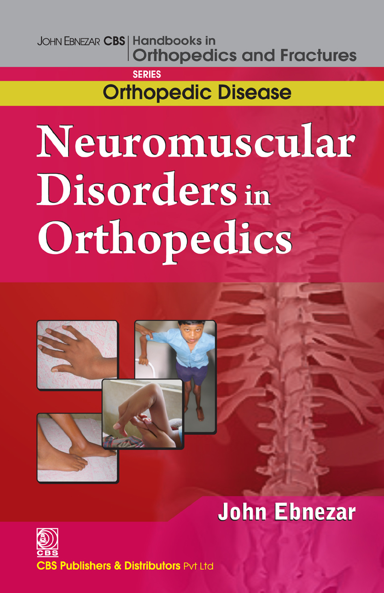 Neuromuscular Disorders In Orthopedics First John Ebnezar