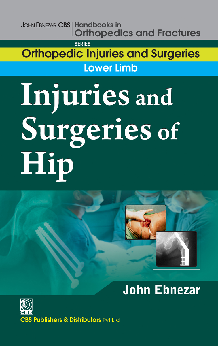Injuries And Surgeries Of Hip First Edition John Ebnezar