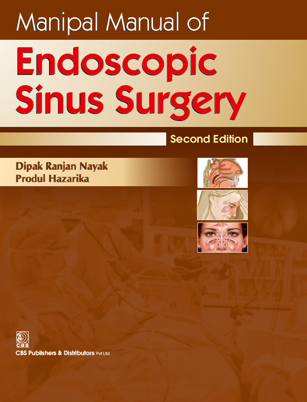Manipal Manual Of Endoscopic Sinus Surgery 2e Second Edition Dr Dipak Ranjan Nayak