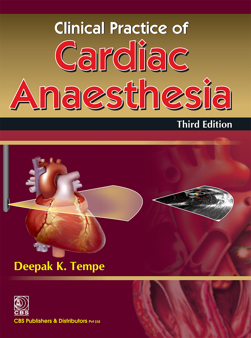 Clinical Practice Of Cardiac Anaesthesia 3e Third Edition Deepak K Tempe