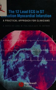 The 12lead Ecg In St Elevation Myocardial Infarction A Practical Approach For Clinicians 1 Edition Bayes De Luna