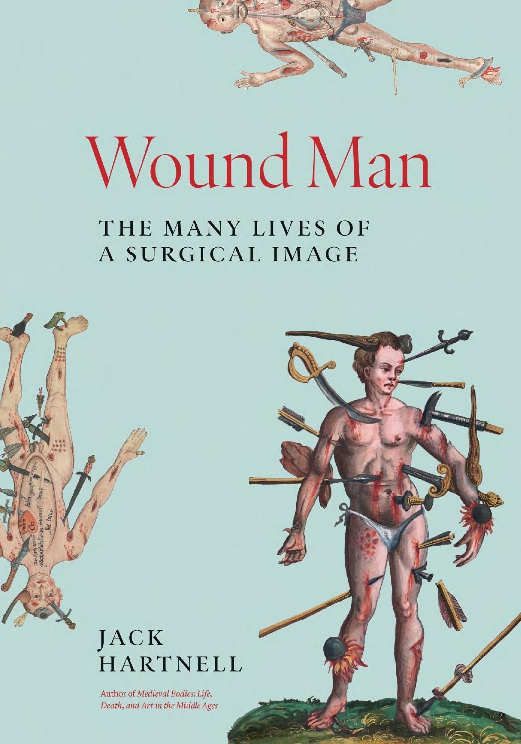 Wound Man The Many Lives Of A Surgical Image 1st Edition Jack Hartnell