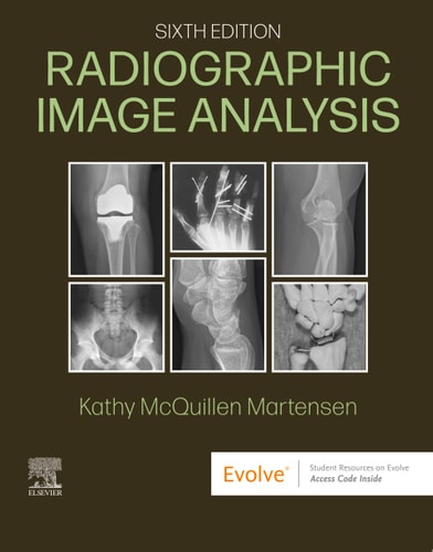 Radiographic Image Analysis 6th Edition Kathy Mcquillen Martensen