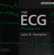 150 Ecg Problems Hampton John R