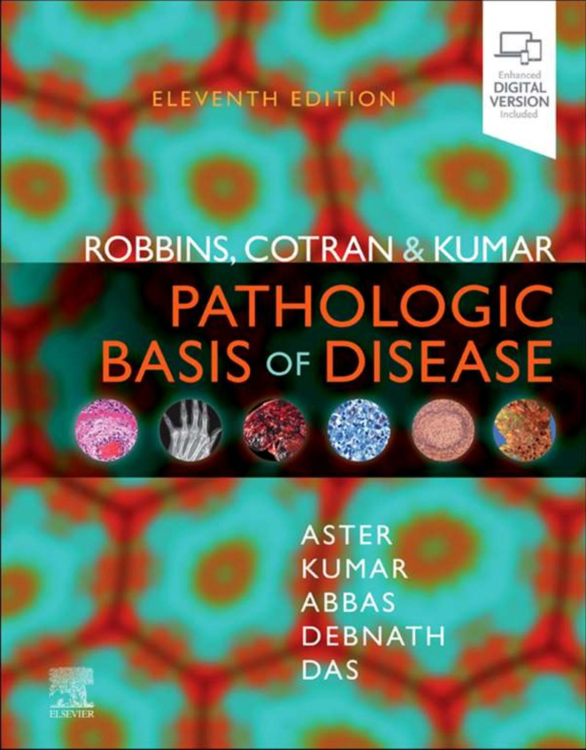 Robbins Cotran Kumar Pathologic Basis Of Disease 11th Edition Jon C Aster Md Phd