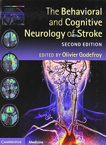 The Behavioral And Cognitive Neurology Of Stroke 2e May 6 2013110701557xcambridge University Presspdf 2nd Edition Olivier Godefroy