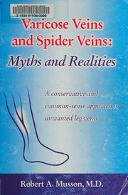 Varicose Veins And Spider Veins Myths And Realities A Conservative And Commonsense Approach To Unwanted Leg Veins Musson