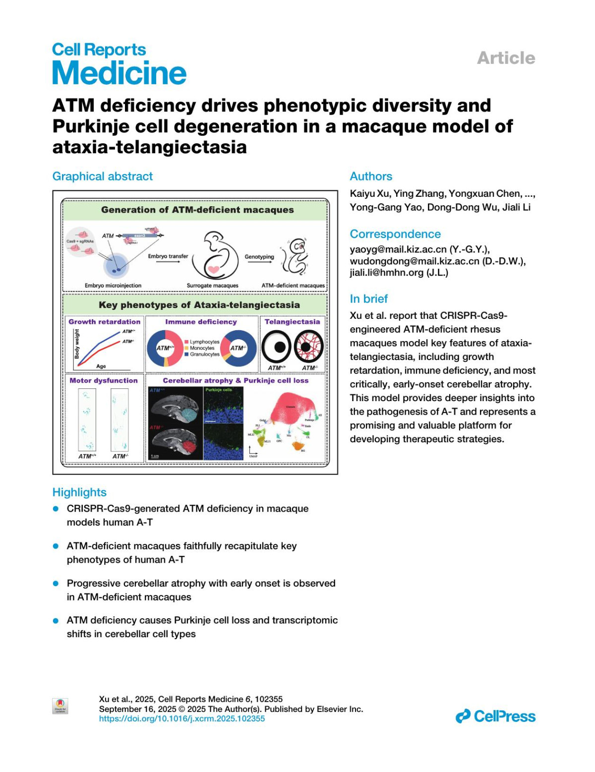 Atm Deficiency Drives Phenotypic Diversity Andpurkinje Cell Degeneration In A Macaque Model Ofataxiatelangiectasia Kaiyu Xu Ying Zhang Yongxuan Chen Xiaojia Zhu Yu Li Longbao Lv Xiechao He Zhengfei Hu Yifan Li Maosen Ye Dewei Jiang Zhanlong He Weihua Jin Yanyan Li Xiaomei Yu Dengfeng Zhang Karl Herrup Ping Zheng Yonggang Yao