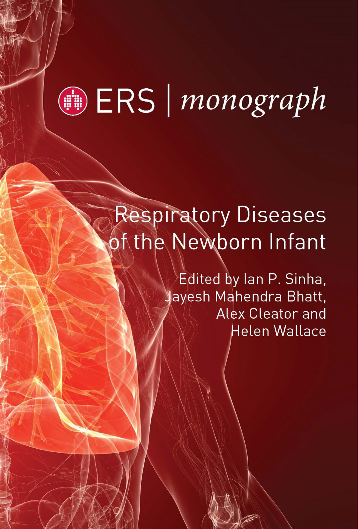 Respiratory Diseases Of The Newborn Infant Ian P Sinha Jayesh Mahendra Bhatt