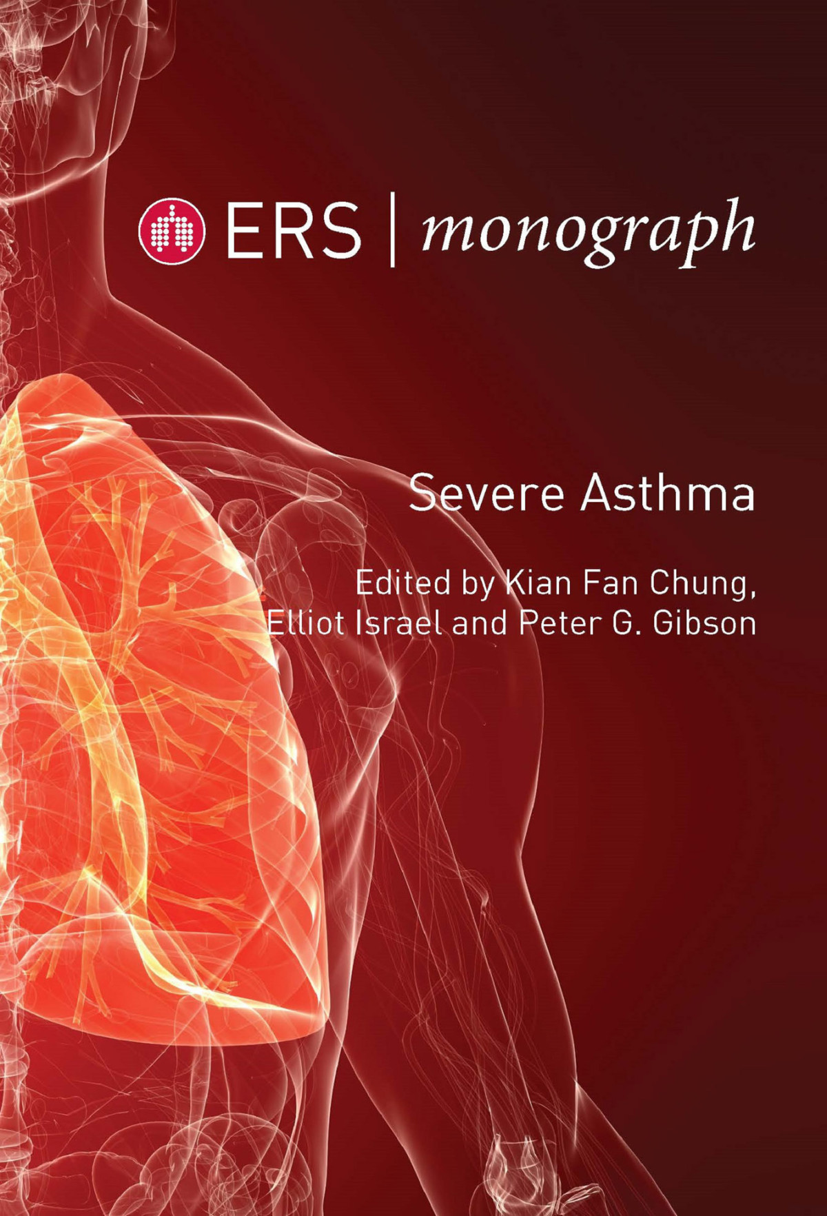 Severe Asthma Kian Fan Chung Elliot Israel Peter G Gibson