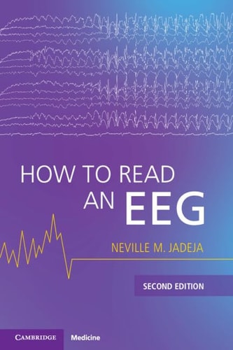How To Read An Eeg 2e July 24 20251009539221cambridge University Presspdf 2nd Edition Neville M Jadeja