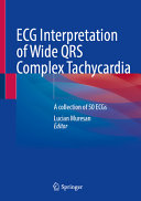Ecg Interpretation Of Wide Qrs Complex Tachycardia A Collection Of 50 Ecgs Oct 2 20253031970292springerpdf Lucian Muresan