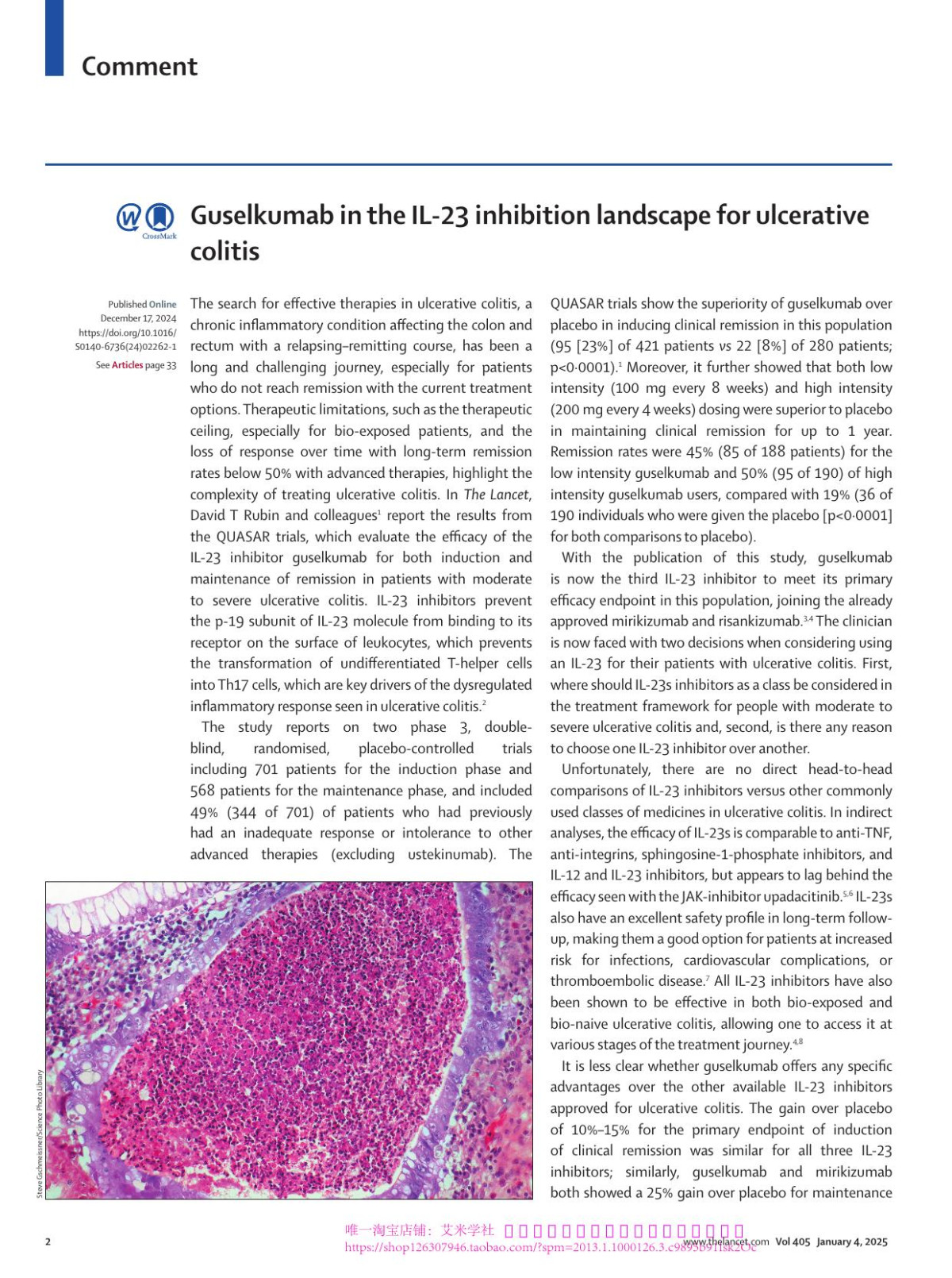 Guselkumab In The Il23 Inhibition Landscape For Ulcerative Colitis Beatriz Gros Laura E Targownik