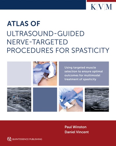 Atlas Of Ultrasoundguided Nervetargeted Procedures For Spasticity 1st Edition Paul Winston