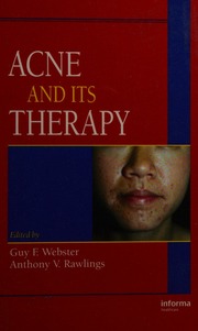 Acne And Its Therapy Webster Guy F Rawlings Anthony V 1958