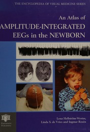 An Atlas Of Amplitudeintegrated Eegs In The Newborn Hellstromwestas