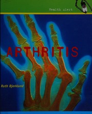 Arthritis Bjorklund Ruth