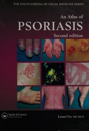 An Atlas Of Psoriasis 2nd Ed Fry Lionel