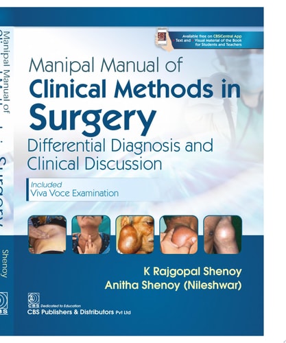 Manipal Manual Of Clinical Methods In Surgery Differential Diagnosis And Clinical Discussion 1st Edition K Rajgopal Shenoy