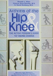 Arthritis Of The Hip And Knee An Active Persons Guide To Taking Charge Allen