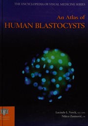 An Atlas Of Human Blastocysts Veeck Lucinda L Zaninovic Nikica