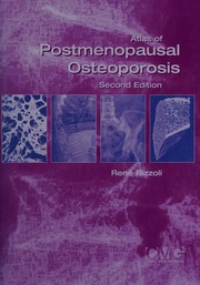 Atlas Of Postmenopausal Osteoporosis 2nd Ed Rizzoli Rene