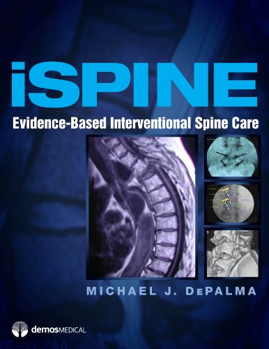Ispine Evidencebased Interventional Spine Care 1st Edition Michael Depalma Md