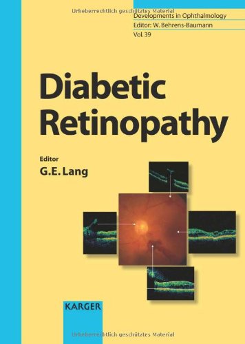 Diabetic Retinopathy 1st Edition Gabriele E Lang