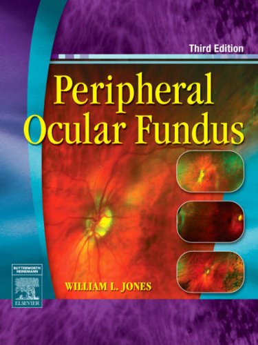 Peripheral Ocular Fundus Third Edition Third Edition William L Jones Od Faao