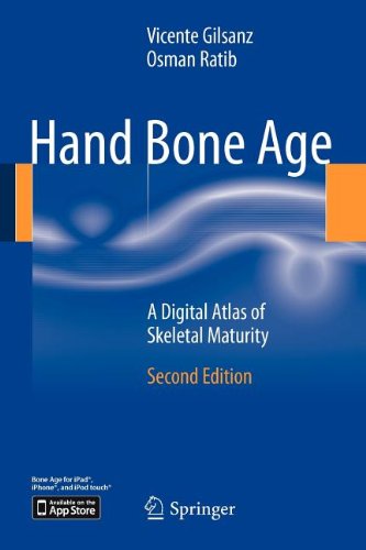 Hand Bone Age A Digital Atlas Of Skeletal Maturity 2nd Edition Vicente Gilsanz