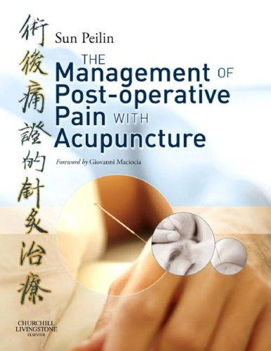 Management Of Postoperative Pain With Acupuncture 1st Edition Peilin Sun Md