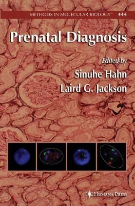 Prenatal Diagnosis 1st Edition Susanne Mergenthalergatfield