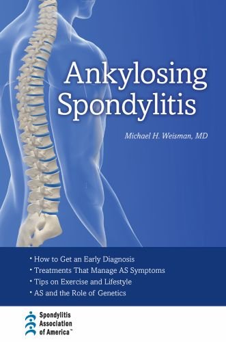 Ankylosing Spondylitis 1st Edition Michael H Weisman